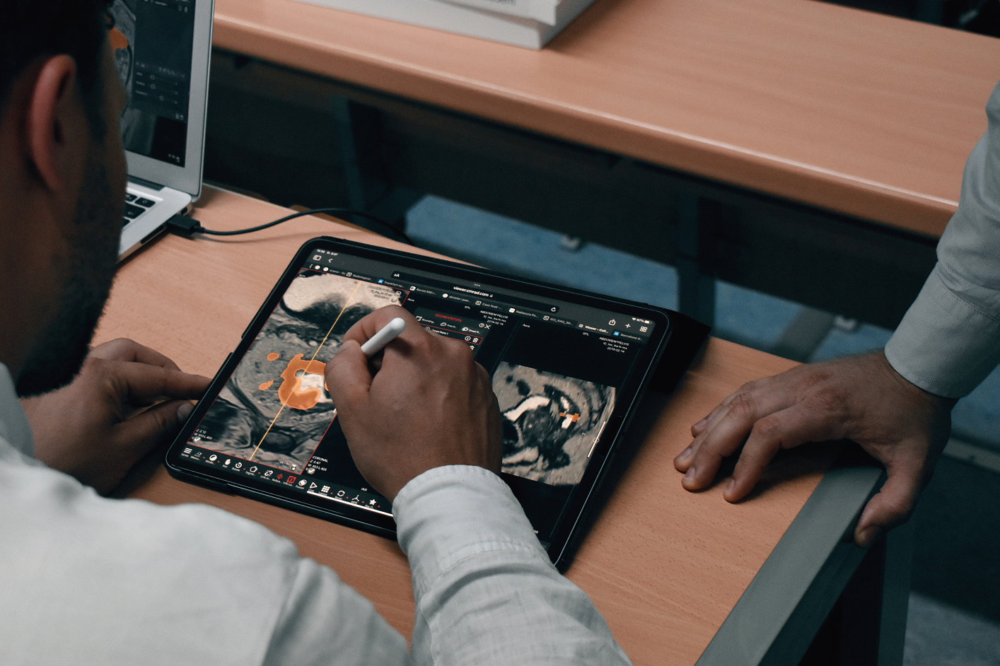 Clinician annotating an MRI on iPad with Apple Pencil