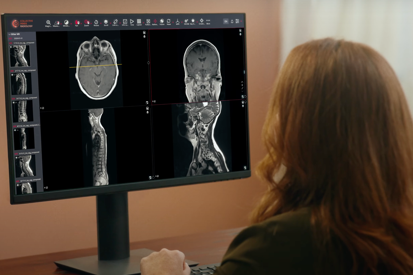 Radiologist reading a brain and spine MRI in the Collective Minds viewer
